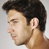KYBELLA®